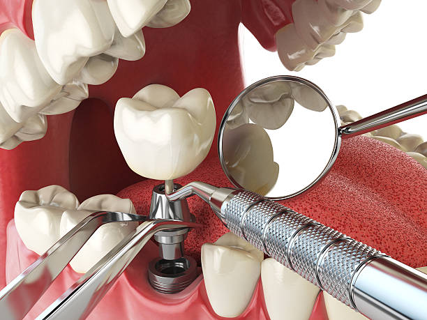 Best Emergency Treatment for Toothache in Middleborough Center, MA